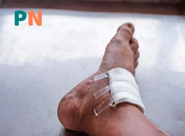 بهترین پانسمان برای زخم دیابتی